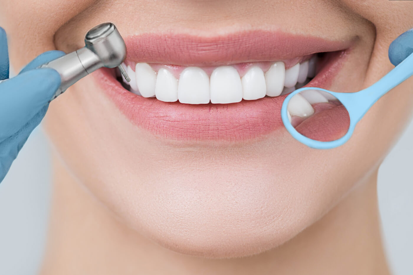 Чистка зубов от налета и камня Air Flow 💎 цены в стоматологии Денталюкс