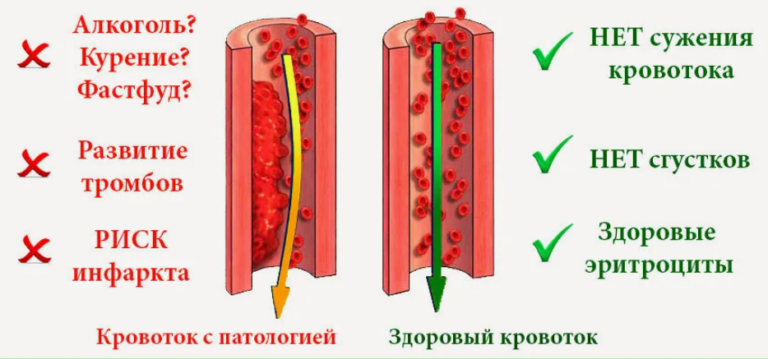 Продукты для разжижения крови и против тромбообразования